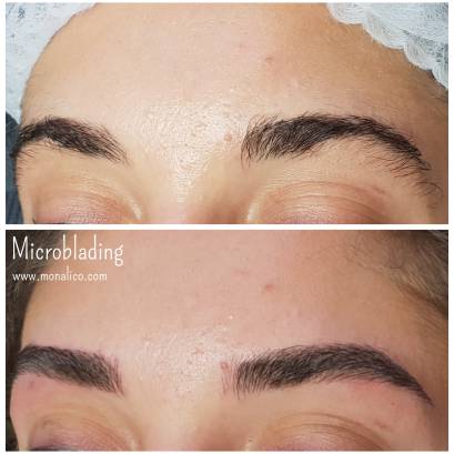 Microblading contraindicaciones