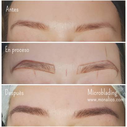 Tratamiento para cejas