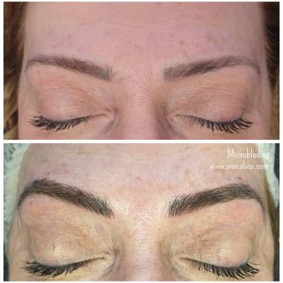 Post microblading