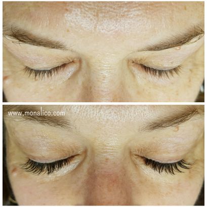 Extensiones pestañas contraindicaciones