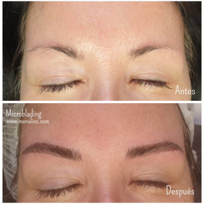Microblading healing process