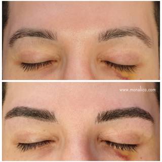 How long does microblading last en Monalico