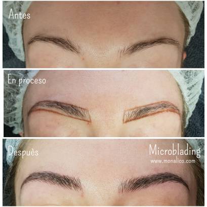 Microblading before and after en Monalico