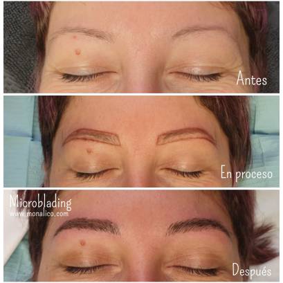 What is microblading en Monalico