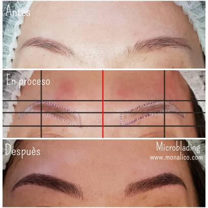 How long does microblading last