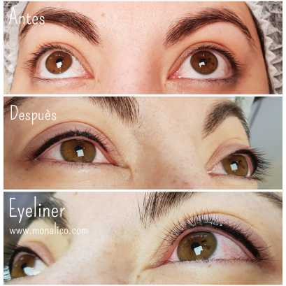 Pigmentación ojos